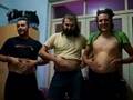 Umbilicus show