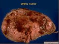 Medical School Pathology, Chapter 10l