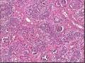 Medical School Pathology, Chapter 10l