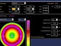 Hyperopia. Topography-guided treatment compared to standard
