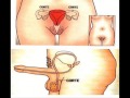 * ~M�todos Contraceptivos ~ *