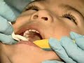 Head Start - Pediatric Oral Health - Region VIII  Dental Health Child Dental Health