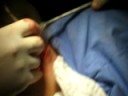 CIRURGIA MAXILO FACIAL Dr MARTINS Dr SARAIVA