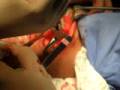 CIRURGIA MAXILO FACIAL Dr MARTINS Dr SARAIVA