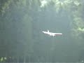 Hit by RC Airplane
