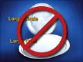 Bard Kugel Hernia Mesh Recall Lawyer Class Action Lawsuit Bard Kugel Hernia Mesh Recall Lawyer Class Action Lawsuit