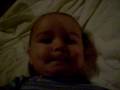 Sidney's tongue frenectomy