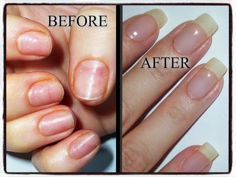how to repair nails after acrylics
