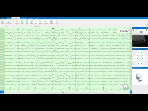 Watch '10yr Old Boy Lying Down Monitored with Zeto EEG'