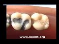 Smoking Teeth