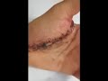 [Video]