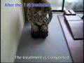 Outcomes of treatment for Coxarthrosis - Example 1