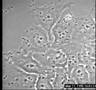 Vibrio cholerae