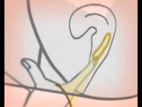 how to fit female condom