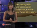 Important Cancer Information