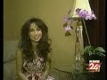 KSEE24 Laser Skin Tightening - IMD Laser Clinic