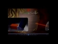 CO2 Laser Revascularization