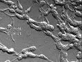 Neuronal Precursors, chain migration of