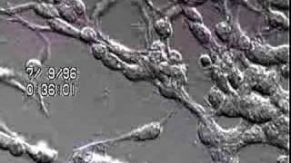 Neuronal Precursors, chain migration of