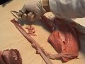 Dissecci� pulmons (3) / Disecci�n pulmones / Lungs disection