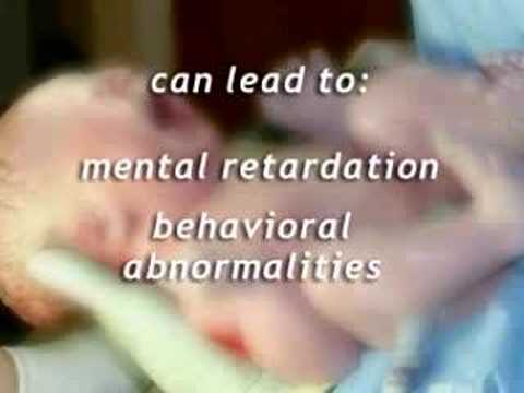 how to treat pku