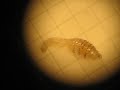 Botfly, Off My Back