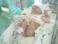 Sofia is changing the nappy