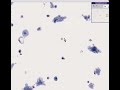 Histopathology Cervix--Atrophy