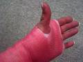 Me in my pink cast