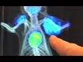 Molecular Imaging Technology at UCLA's Jonsson Cancer Center