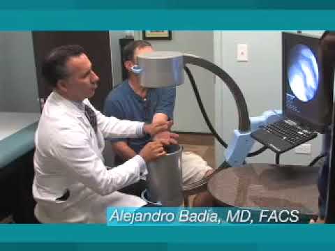 Hombro Congelado, Artritis del Hombro Glenoumeral Ortopeda Cirujano de Hombro Dr. Alejandro Badia, Tendonitis de la Mano, Tratamiento Desgarramiento del Manguito Rotador