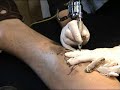 Trigrenouille