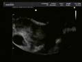 videos de VTS_01_1_mpeg4.avi