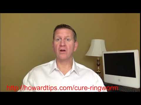 how to cure ringworm