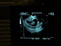 11 Weeks