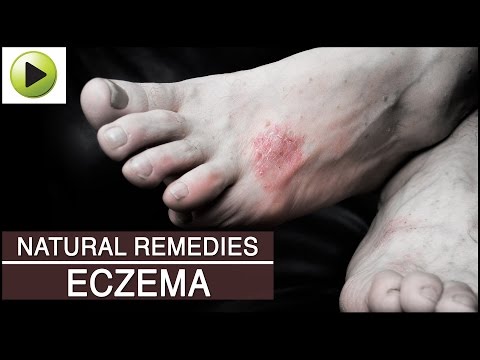 how to naturally heal eczema