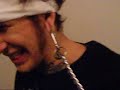 Ear ripped open