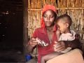 UNICEF: Local therapeutic feeding centers in Ethiopia treat malnutrition