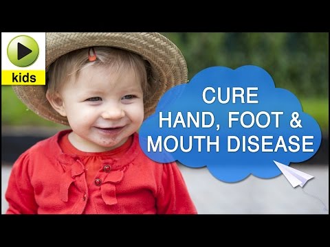 how to cure hfmd