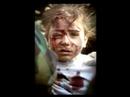 Anti-War Montage Anti-War Montage