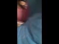 Puss shoots out of dogs abscess