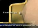 Breast Health Solutions - NeoMatrix