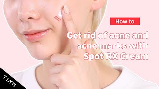 TIAM Get rid of acne and acne mark with Spot RX Cr