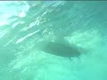 run over by surfer