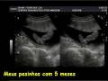 videos de video clip Heitor a sos