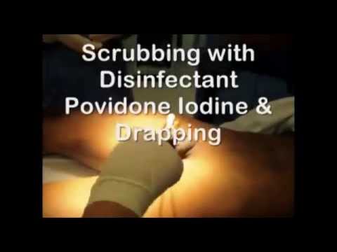 Adult Disposable Circumcision Device by Circumtech Part 1
