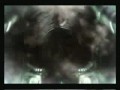 ill-attack.html