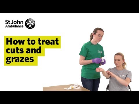 how to treat cuts