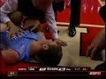 Hansbrough injury