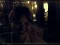 amputee treffen 2